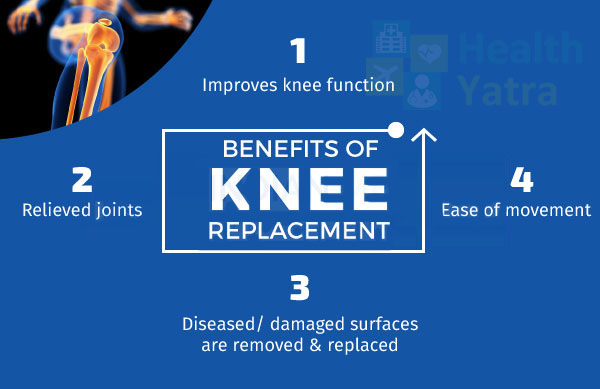 Benefits of Knee Replacement Surgery in India