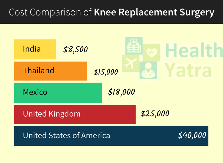 भारत में घुटने की रिप्लेसमेंट सर्जरी की लागत कितनी है?