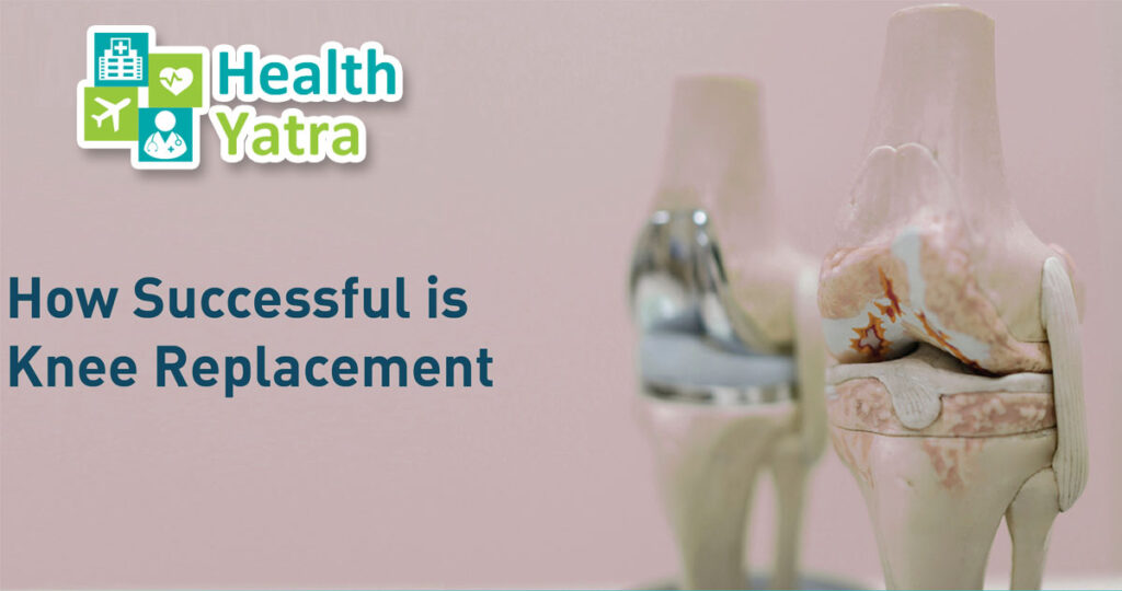 Low Cost Knee Replacement Surgery with HealthYatra.com