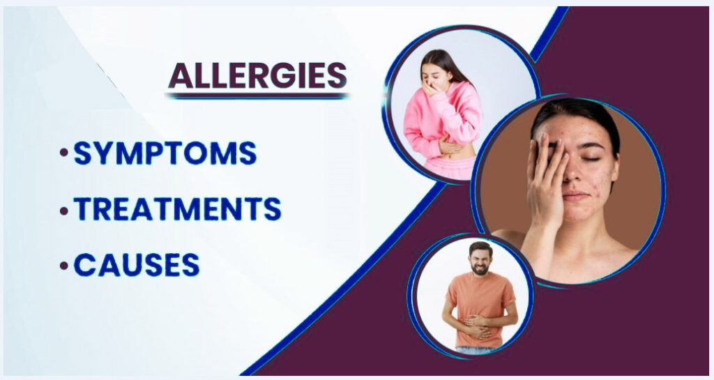 Understanding Allergies Symptoms Causes and Management