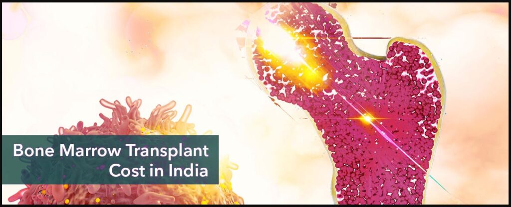 Autologous Bone Marrow Transplant in India
