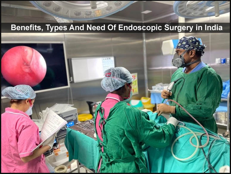 Benefits Types And Need Of Endoscopic Surgery in India