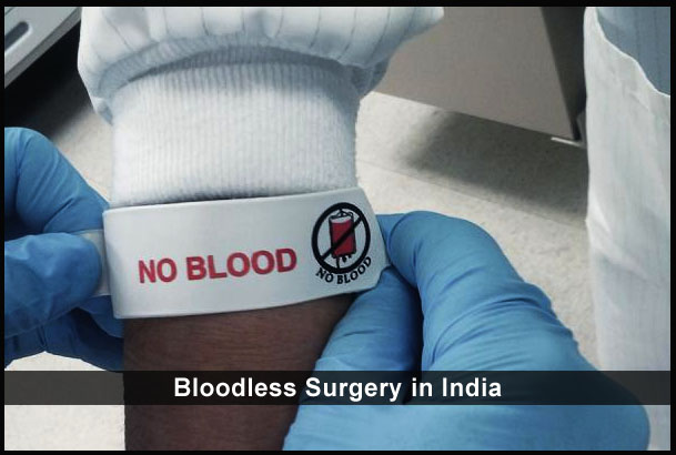 جراحة بدون دم في الهند