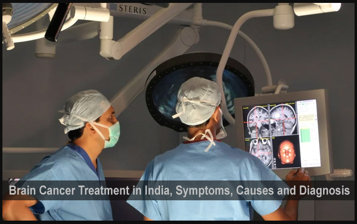 भारत में ब्रेन कैंसर का इलाज, लक्षण, कारण और निदान