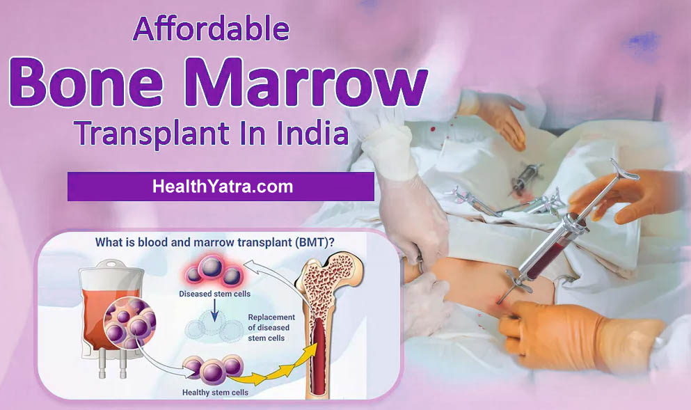 Low Cost Bone Marrow Transplant in India