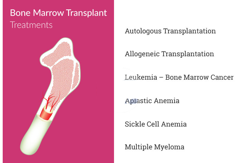 bone marrow transplant treatments in India