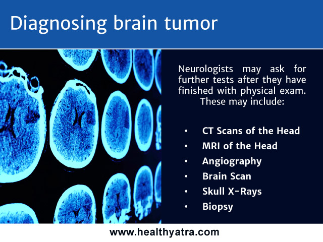 brain tumor india diagnosing
