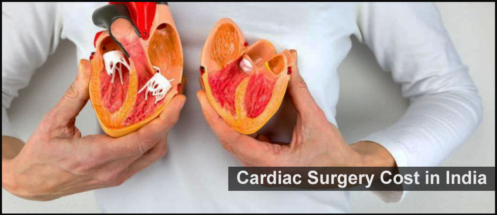 Cardiac Surgery Cost in India