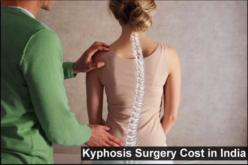 Kyphosis Surgery Cost in India