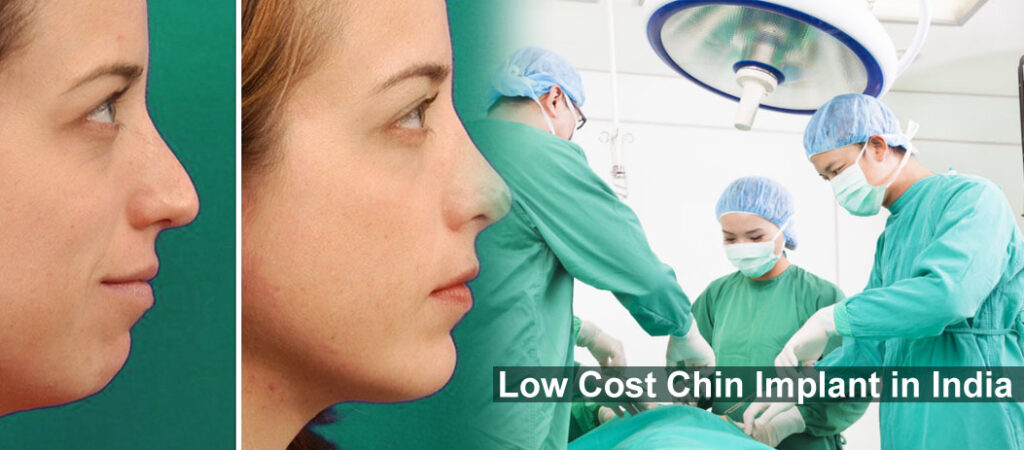 Low Cost Chin Implant in India