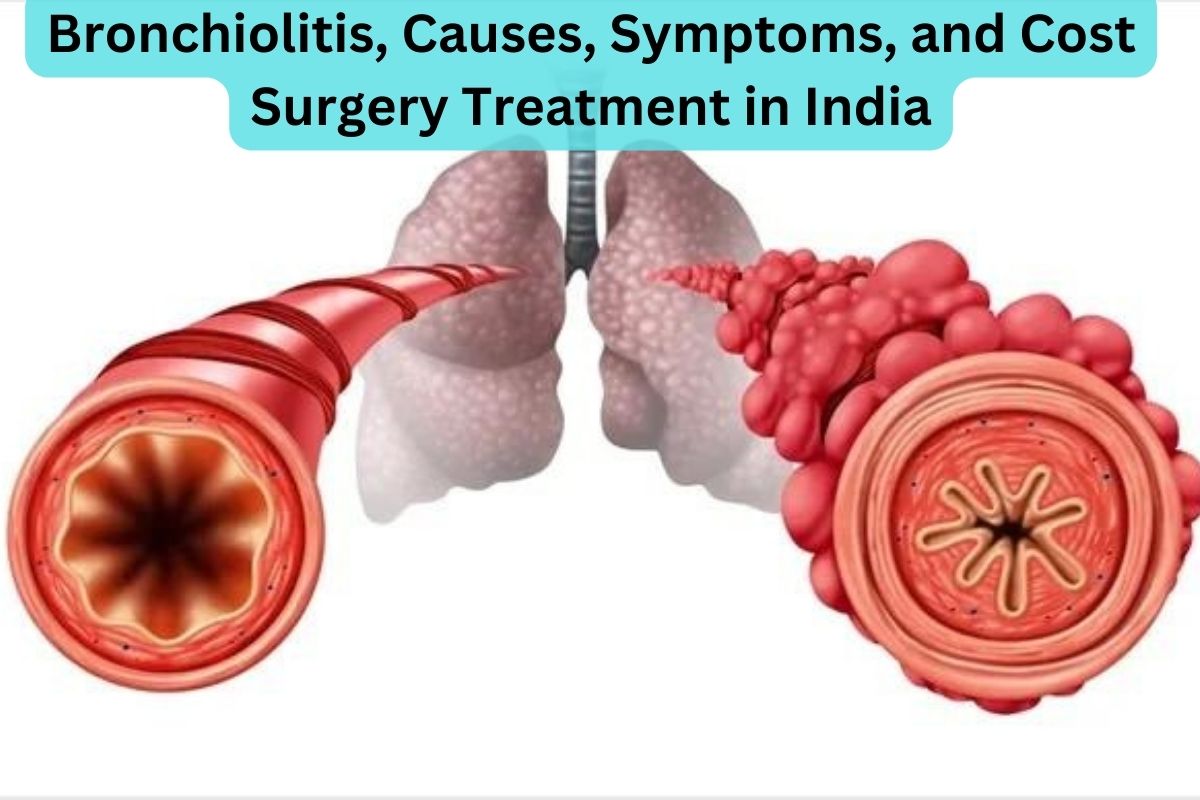 Bronchiolitis Causes Symptoms and Cost Surgery Treatment in India
