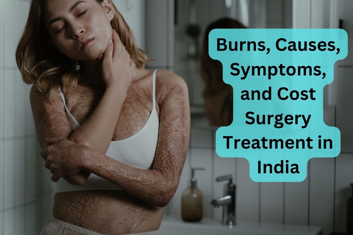 Burns Causes Symptoms and Cost Surgery Treatment in India