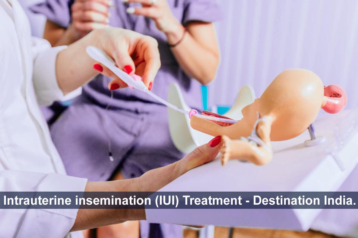 Intrauterine insemination IUI Treatment Destination India.